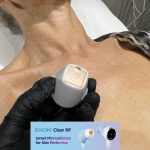 BTL-Exion-Clear-RF-launches-at-S-Thetics-Clinic-in-Beaconsfield-clear-skin2.pngUntitled-2