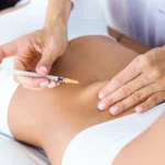 stomache-injection-body-page